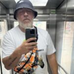 «Не береже молодість»: пластичний хірург оцінив зміни у зовнішності Потапа за останні роки…