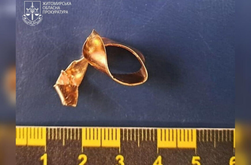 Плоскогубцями здер з пальця: на Житомирщині засудили…